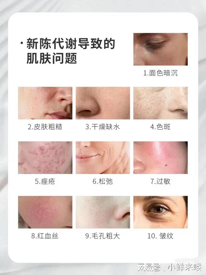 九游娱乐平台：给你的肌肤注入一剂加速代谢的魔法药水叮~鲜女护肤小知识来喽(图3)