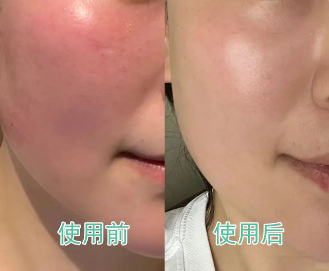 九游娱乐平台：不用昂贵护肤品！一瓶芦荟胶好用到爆！保湿、修护一手抓！全家都能用！(图6)