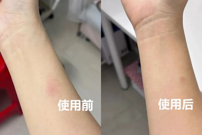 九游娱乐平台：不用昂贵护肤品！一瓶芦荟胶好用到爆！保湿、修护一手抓！全家都能用！(图8)
