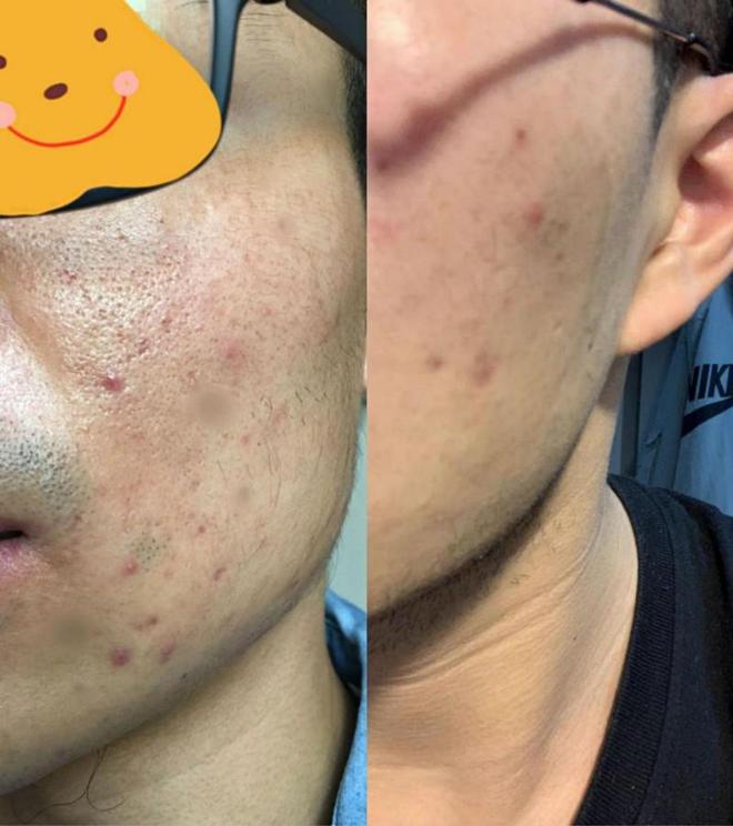 九游娱乐平台：男士洗面奶哪个牌子最好？清爽洁面产品轻松拥有好气色！(图4)