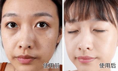 九游娱乐：2024TOP10淡斑排行榜名牌深究：淡斑祛斑效果第一护肤品(图4)
