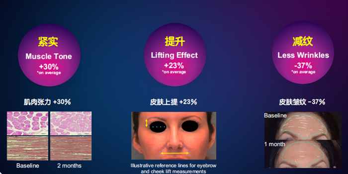 九游娱乐平台：深圳贝比蓝：EMFACE美菲斯助你拥抱2024抗衰老新趋势(图3)