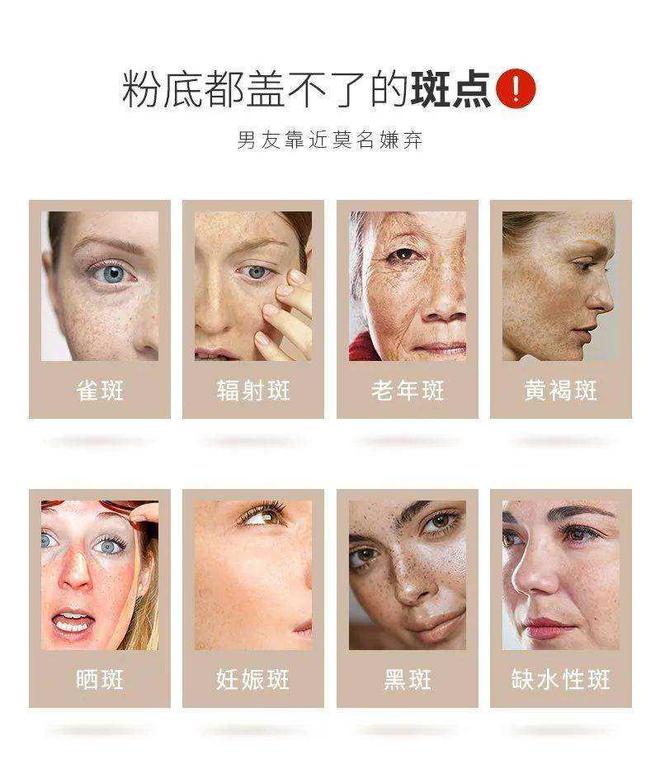 九游娱乐平台：国家唯一认证的祛斑产品都有哪个？2024权威又好用的是哪款？(图1)
