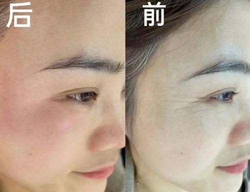 九游娱乐网站：抗皱纹的护肤品有哪些？2024高性价比产品分享(图4)