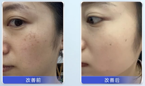 九游娱乐：新锐国货之光：纽莱伊美—领航皮肤学级护肤重塑美白淡斑新风尚(图3)