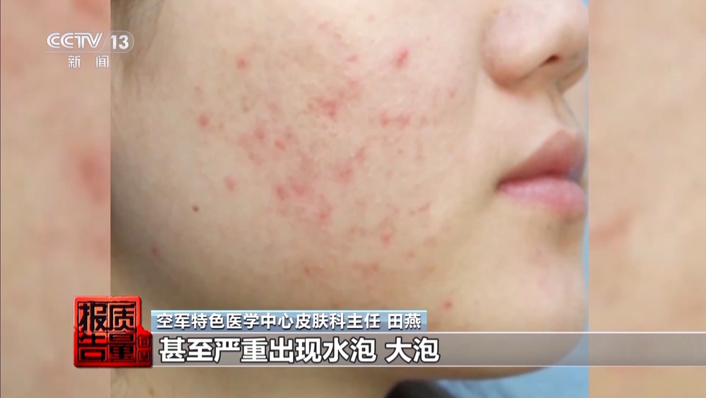 九游娱乐平台：每周质量报告丨揭开防晒化妆品的“迷雾”“防护”还是“防晒”？(图4)