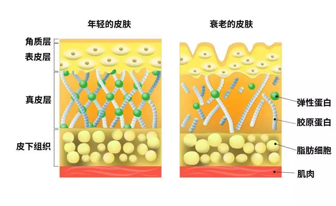 九游娱乐平台：润致娃娃针科普：花了大价钱护肤为什么你还是老了？(图2)