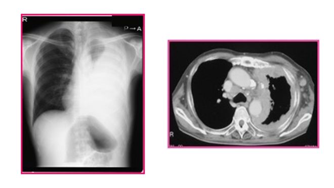 九游娱乐平台：颠覆！68岁日本老太惨死凶手竟是50年前用过的化妆品！潜伏期长到令人窒息(图12)
